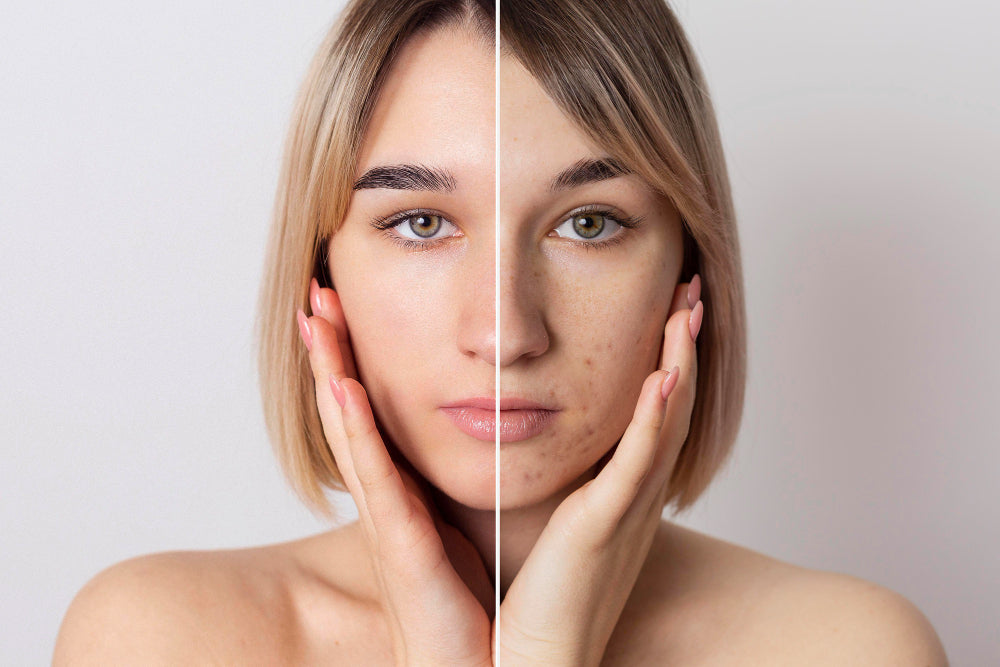 What Causes Skin Discoloration?