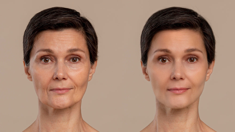 What Causes Sagging Skin