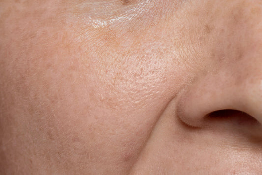 How to Improve Skin Texture