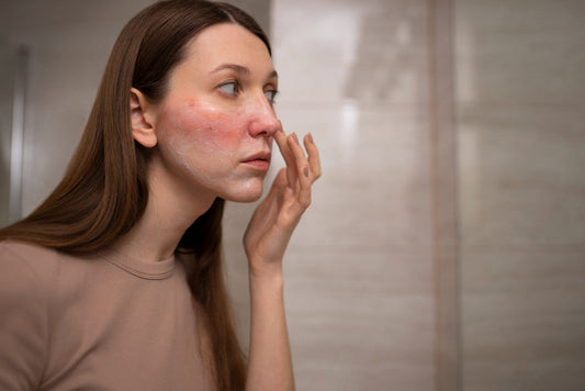 Does Rosacea Get Worse with Age?