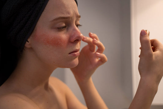 How to Get Rid of Discoloration on Face?