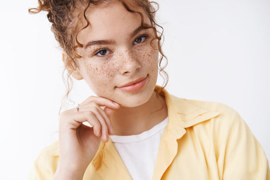 What is the Difference Between Freckles and Sunspots?