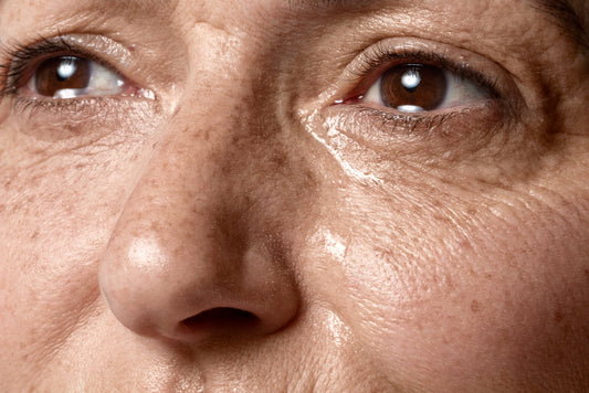 How to Get Rid of Dark Spots on Face?
