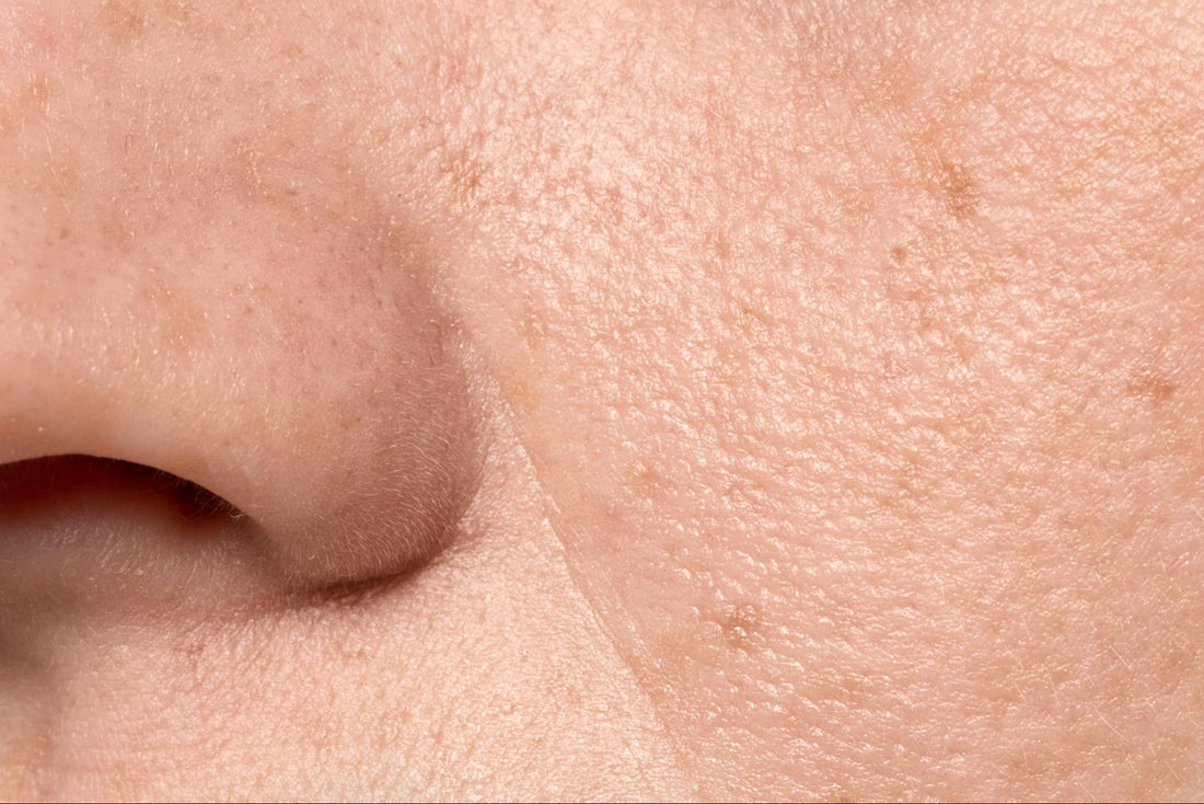 How to Fix Enlarged Pores: A Guide to Smoother, Refined Skin