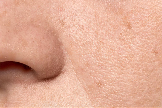 How to Fix Enlarged Pores: A Guide to Smoother, Refined Skin