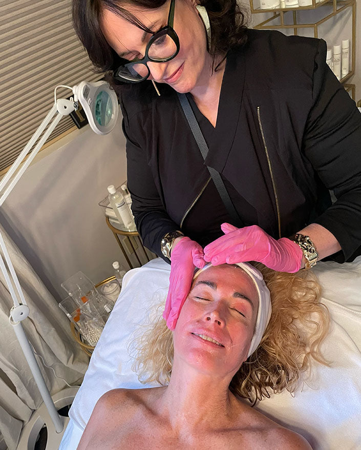 microneedling burlington